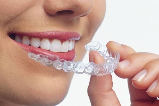 Invisalign Tedavisi